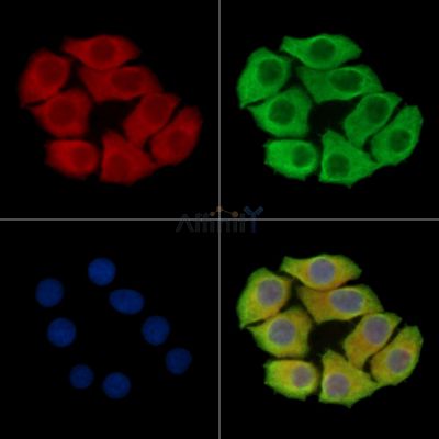 CDKL3 Antibody - DF15556 staining Hela cells by IF/ICC.