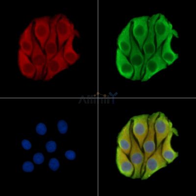 ARL6IP1 Antibody - DF15567 staining Hela cells by IF/ICC.