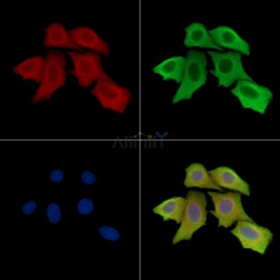 TMEM5 Antibody - DF15656 staining Hela cells by IF/ICC.
