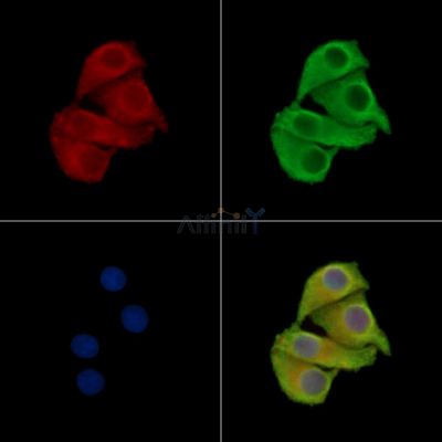 ADAM22 Antibody - DF15689 staining Hela cells by IF/ICC.