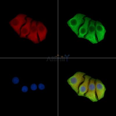 TRAPPC4 Antibody - DF15720 staining Hela cells by IF/ICC.