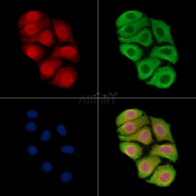 KIF14 Antibody - DF15723 staining Hela cells by IF/ICC.