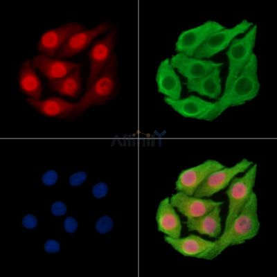 RFX2 Antibody - DF15783 staining Hela cells by IF/ICC.