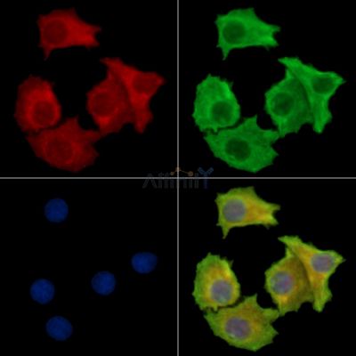 SLC36A2 Antibody - DF15880 staining Hela cells by IF/ICC.