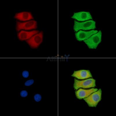 RNF186 Antibody - DF15951 staining Hela cells by IF/ICC.