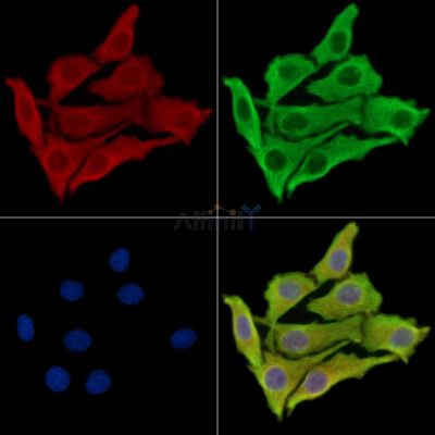 PLEKHG6 Antibody - DF16010 staining Hela cells by IF/ICC.