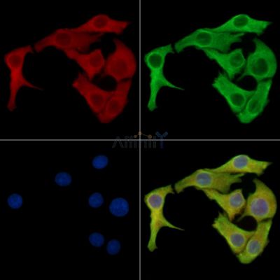 FSCN3 Antibody - DF16011 staining Hela cells by IF/ICC.