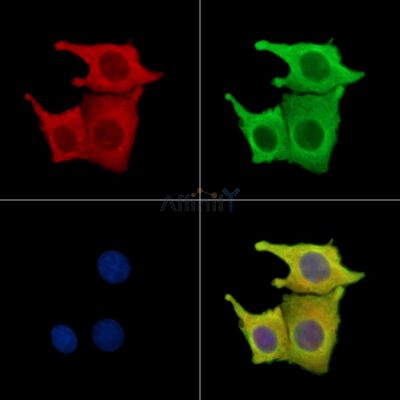 FRMPD3 Antibody - DF16013 staining Hela cells by IF/ICC.