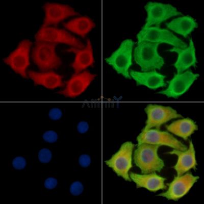 GAREM2 Antibody - DF16019 staining Hela cells by IF/ICC.