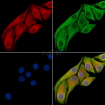 CCDC47 Antibody - DF16020 staining Hela cells by IF/ICC.