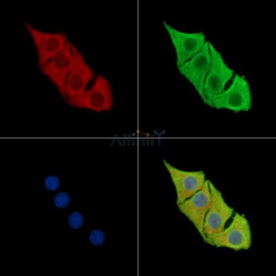 ESPN Antibody - DF16023 staining Hela cells by IF/ICC.