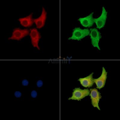 NEK10 Antibody - DF16028 staining Hela cells by IF/ICC.