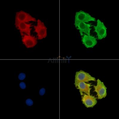CCDC3 Antibody - DF16031 staining Hela cells by IF/ICC.