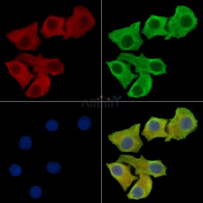 ABHD15 Antibody - DF16047 staining Hela cells by IF/ICC.