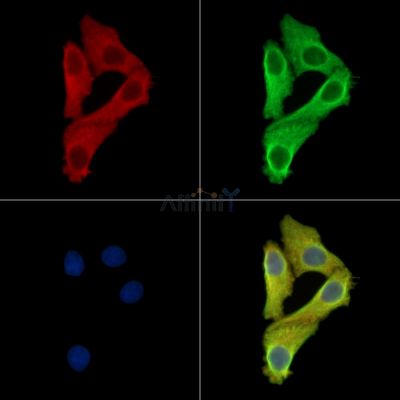 TRMT10C Antibody - DF16052 staining Hela cells by IF/ICC.