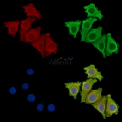 CLRN3 Antibody - DF16063 staining Hela cells by IF/ICC.