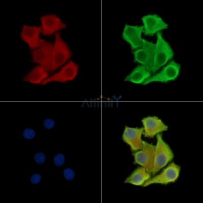 TUFT1 Antibody - DF16085 staining Hela cells by IF/ICC.