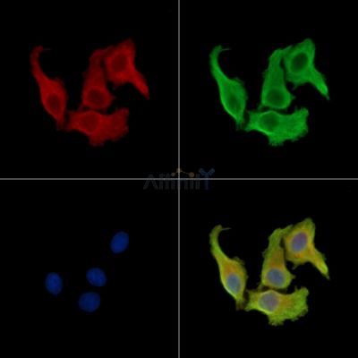 STKLD1 Antibody - DF16087 staining Hela cells by IF/ICC.