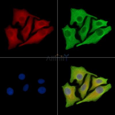 TBCB Antibody - DF16090 staining Hela cells by IF/ICC.