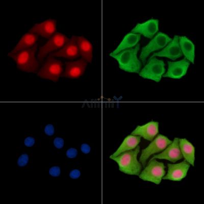 ZER1 Antibody - DF16093 staining Hela cells by IF/ICC.