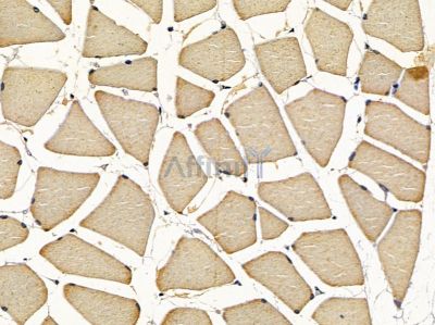 CPQ Antibody - DF16094 at 1/100 staining rat muscle tissue by IHC-P.