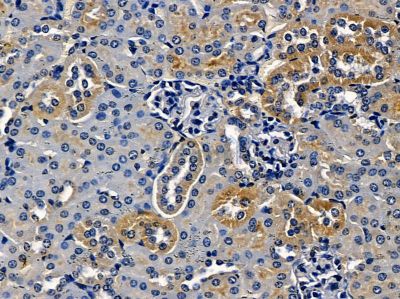 MANBA Antibody - DF16095 at 1/100 staining mouse kidney tissue by IHC-P.