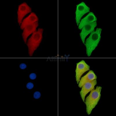 MANBA Antibody - DF16095 staining Hela cells by IF/ICC.