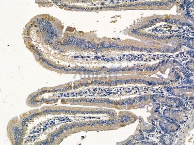 MSTO1 Antibody - DF16097 at 1/100 staining mouse colorectal tissue by IHC-P.