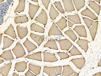 TMEM147 Antibody - DF16117 at 1/100 staining rat muscle tissue by IHC-P.