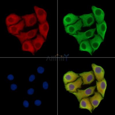 ARL14 Antibody - DF16123 staining Hela cells by IF/ICC.