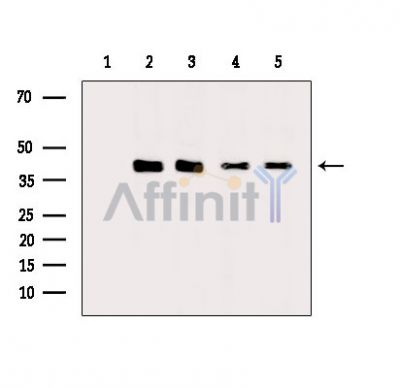 IFRD1 Antibody - Western blot analysis of extracts from various samples, using IFRD1 Antibody.