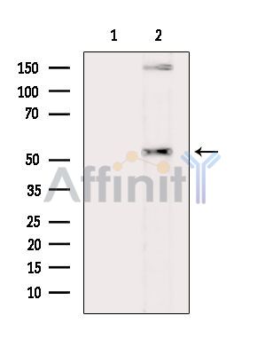 BTBD14B Antibody - Western blot analysis of extracts from HepG2 cells(heat-shock treatment), using BTBD14B Antibody.