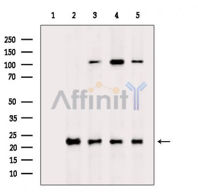 HSPB8 Antibody - Western blot analysis of extracts from various samples, using HSPB8 Antibody.