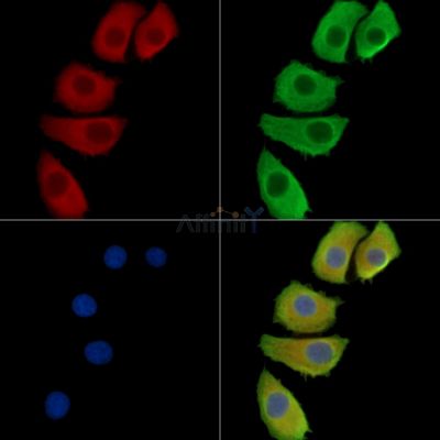 HOR5'Beta13 Antibody - DF2718 staining Hela cells by IF/ICC.
