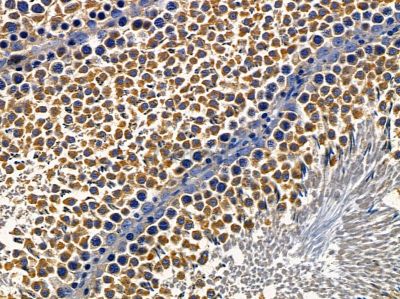 ST5 Antibody - DF3226 at 1/100 staining rat testis tissue by IHC-P.