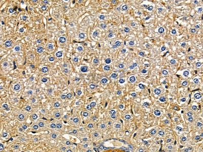 ARFGAP3 Antibody - DF3748 at 1/100 staining mouse liver tissue by IHC-P.