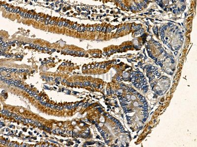 ARFGAP3 Antibody - DF3748 at 1/100 staining mouse colorectal tissue by IHC-P.