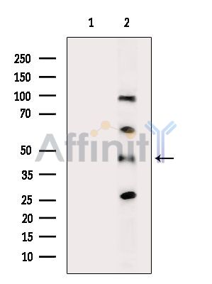 AKR1C2 Antibody - Western blot analysis of extracts from Hela cells(heat-shock treatment), using AKR1C2 Antibody.