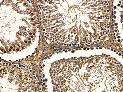 ALS2CR13 Antibody - DF3776 at 1/100 staining rat testis tissue by IHC-P.