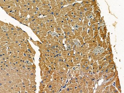 Atrophin 1 Antibody - DF3824 at 1/100 staining mouse heart tissue by IHC-P.