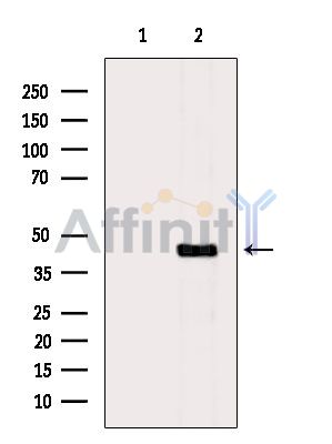 LYAR Antibody - Western blot analysis of extracts from Mouse brain, using LYAR Antibody.