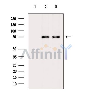 CEP76 Antibody - Western blot analysis of extracts from various samples, using CEP76 Antibody.