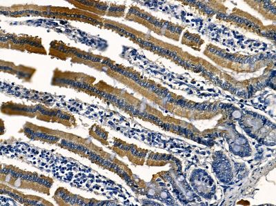 DHPS Antibody - DF3987 at 1/100 staining mouse colorectal tissue by IHC-P.