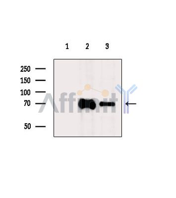 DNAI2 Antibody - Western blot analysis of extracts from various samples, using DNAI2 Antibody.
