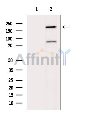 TUBGCP6 Antibody - Western blot analysis of extracts from Hela cells(heat-shock treatment), using TUBGCP6 Antibody.