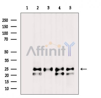 PGRMC2 Antibody - Western blot analysis of extracts from various samples, using PGRMC2 Antibody.