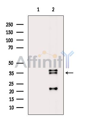 SLC25A11 Antibody - Western blot analysis of extracts from Hela cells(heat-shock treatment), using SLC25A11 Antibody.