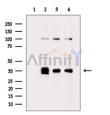PTGR1 Antibody - Western blot analysis of extracts from various samples, using PTGR1 Antibody.