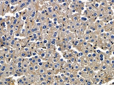 PTGR1 Antibody - DF4216 at 1/100 staining mouse liver tissue by IHC-P.