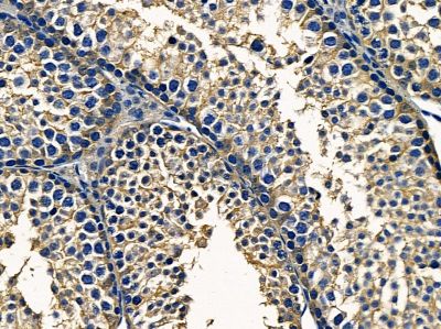 PTGR1 Antibody - DF4216 at 1/100 staining mouse testis tissue by IHC-P.